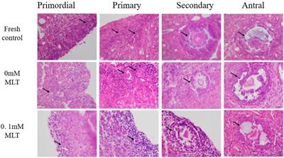 Melatonin Inhibits Oxidative Stress and Apoptosis in Cryopreserved Ovarian Tissues via Nrf2/HO-1 Signaling Pathway